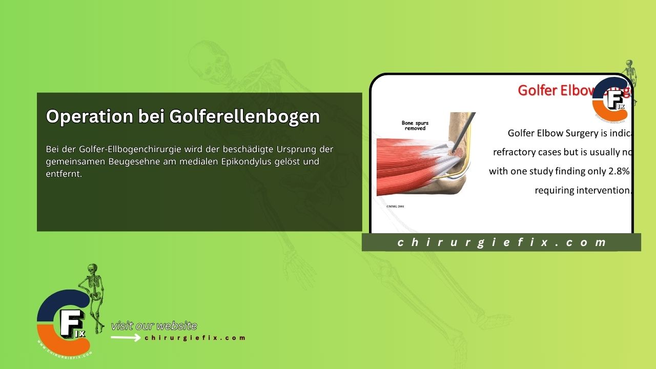 Golfer Elbow Surgery