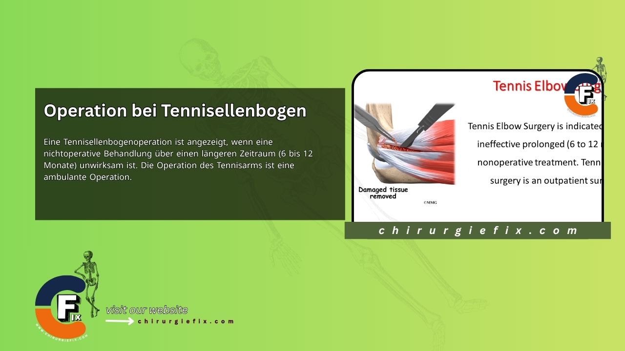 Tennis Elbow Surgery