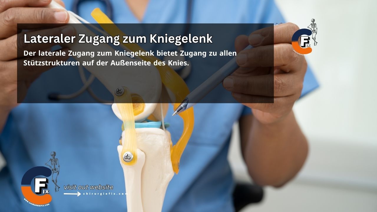 Lateral Approach to Knee