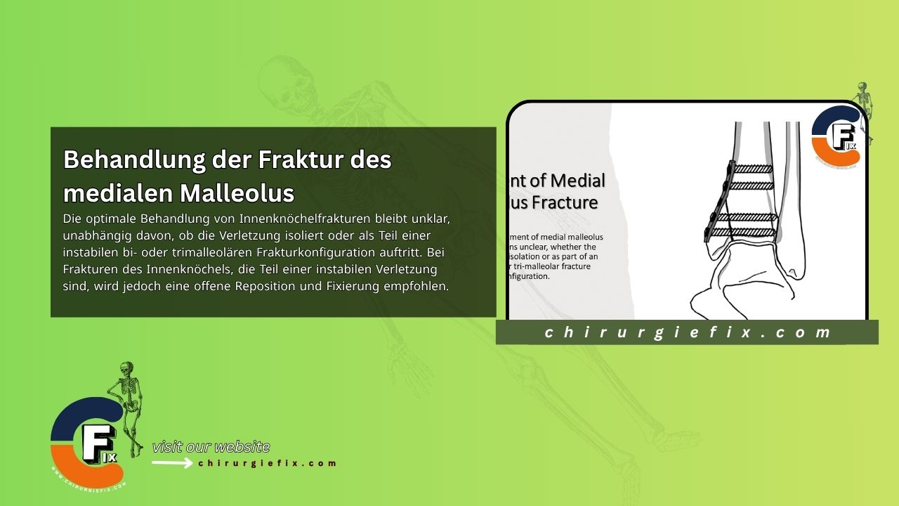 treatment of medial malleolus fracture