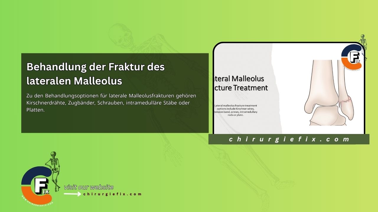 Lateral Malleolus Fracture Treatment