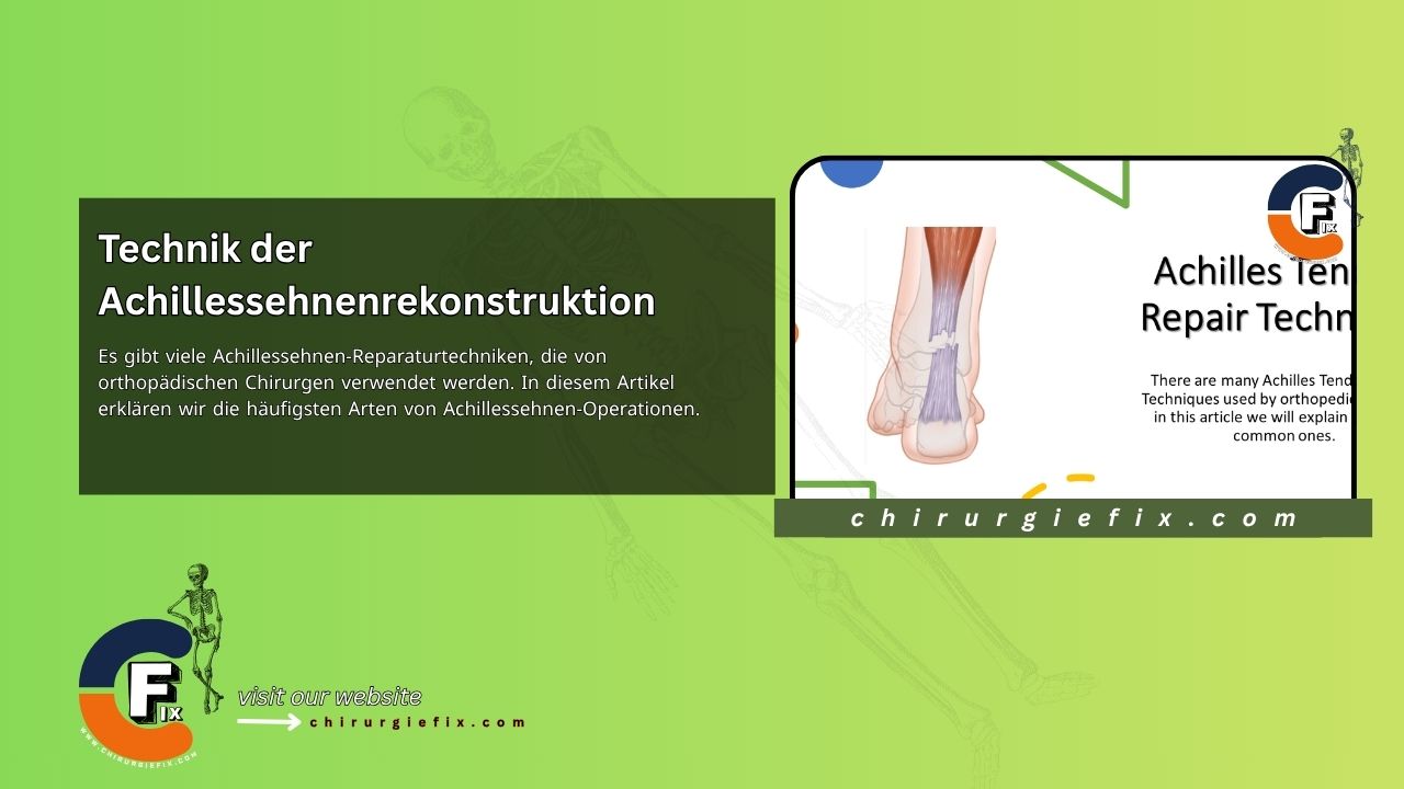 Achilles Tendon Repair Technique