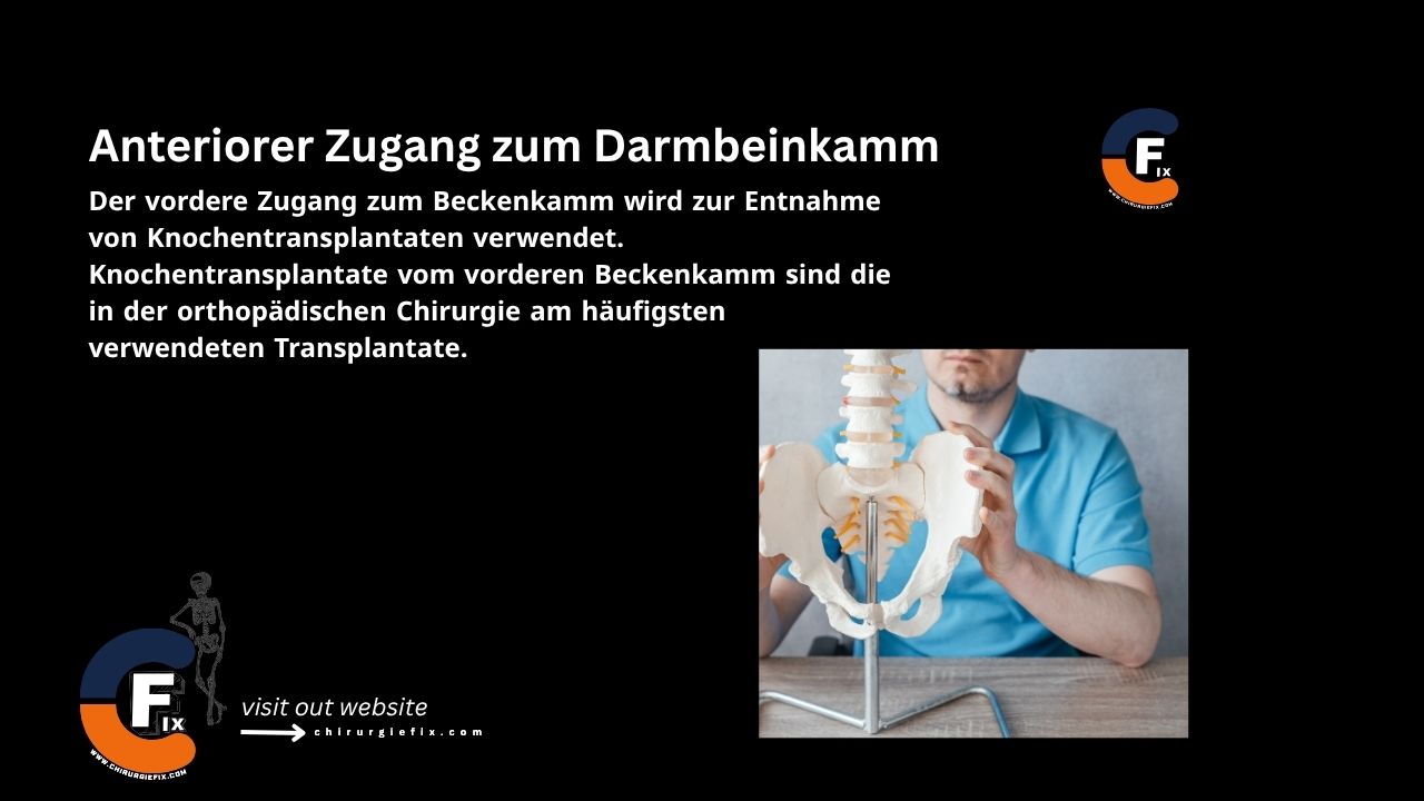 Anterior Approach to the Iliac Crest
