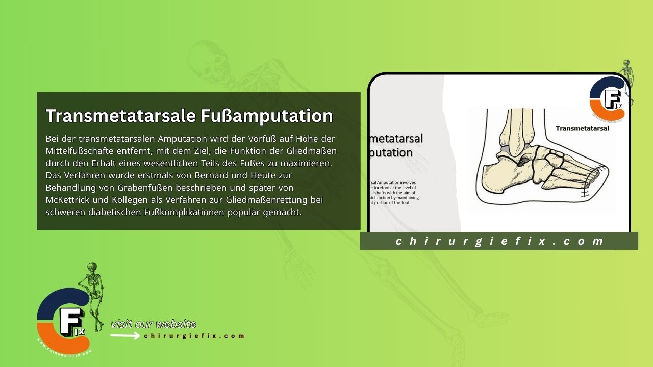 Transmetatarsal Amputation