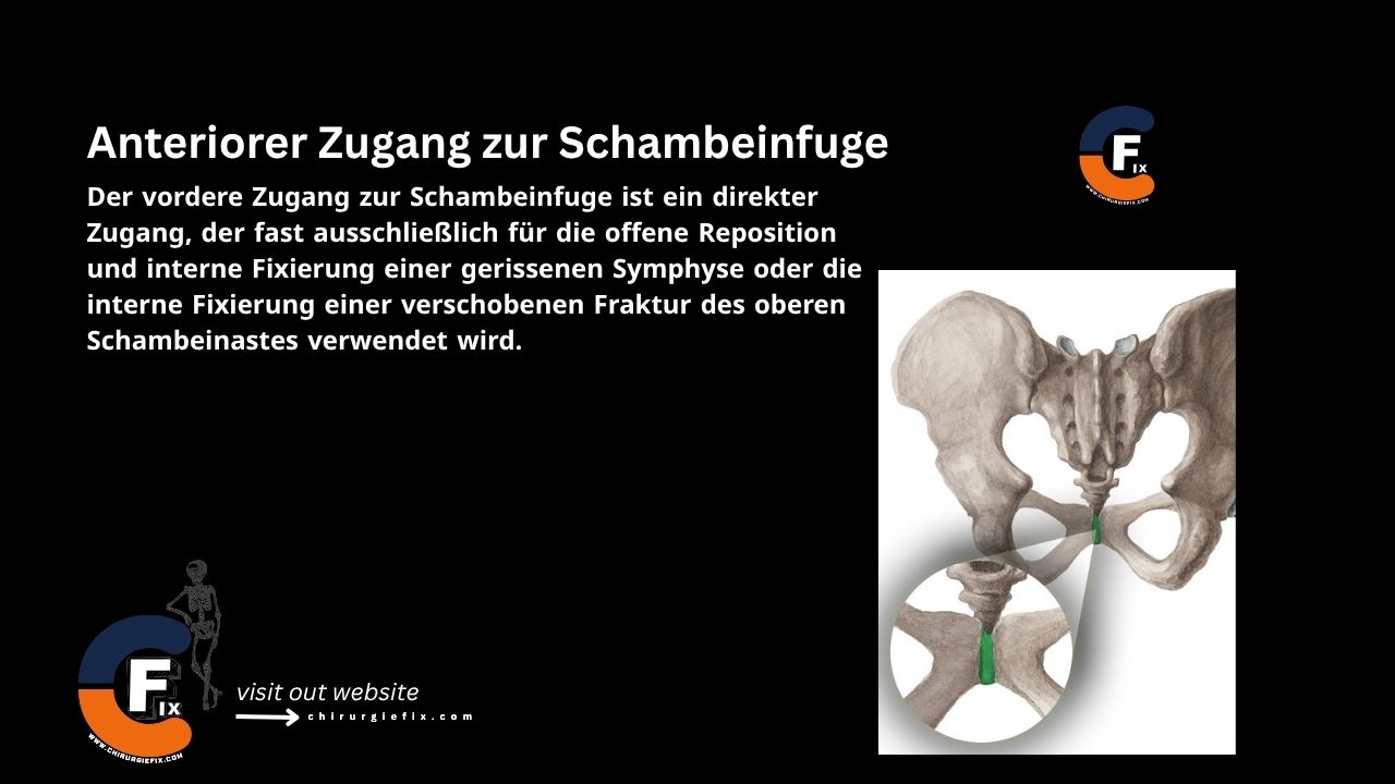 anterior approach to pubic symphysis
