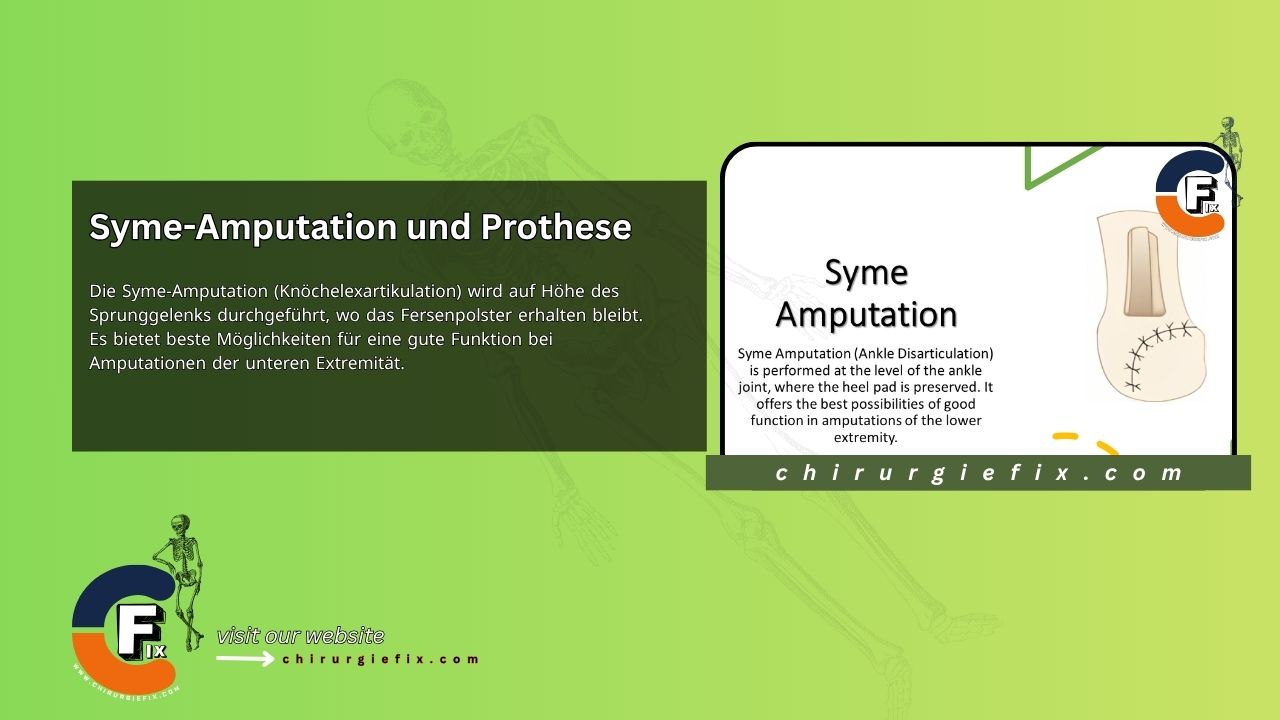 Syme Amputation