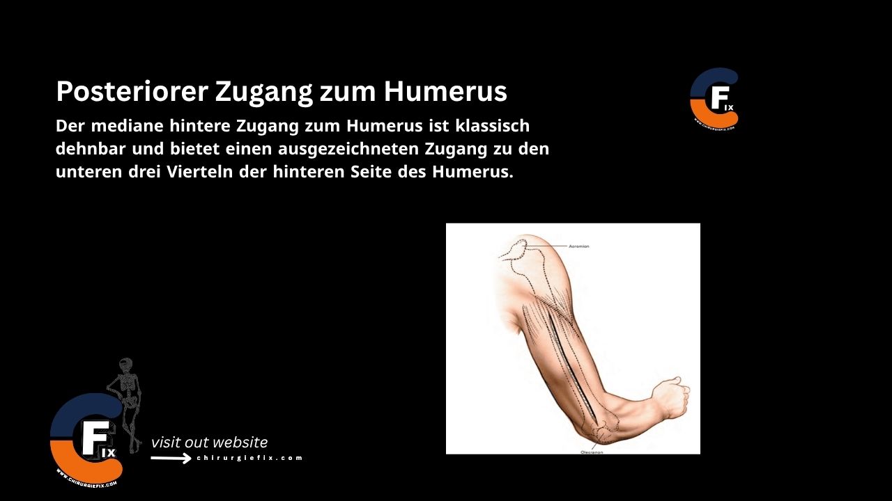 Posterior Approach to the Humerus