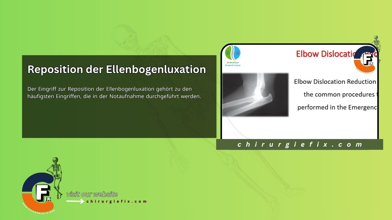 Elbow Dislocation Reduction