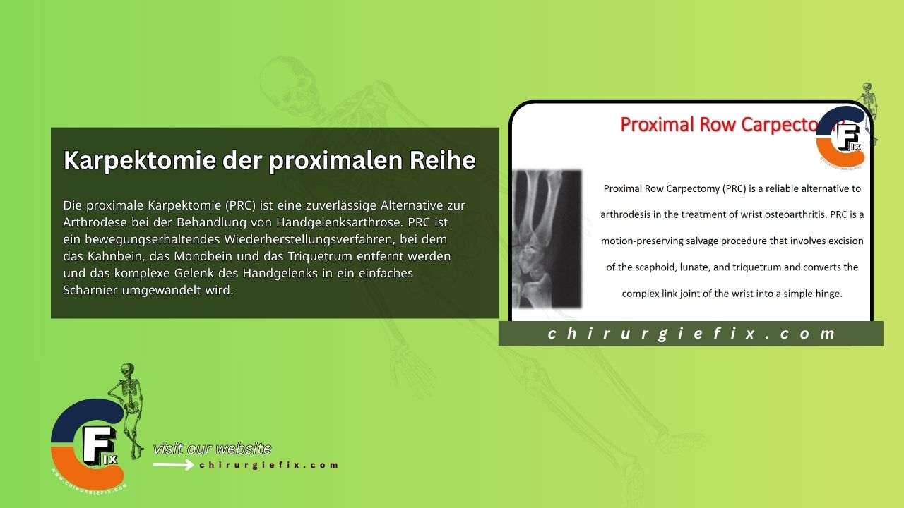 Proximal Row Carpectomy