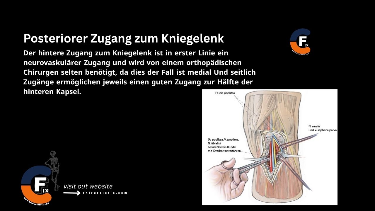 Posterior Approach To Knee