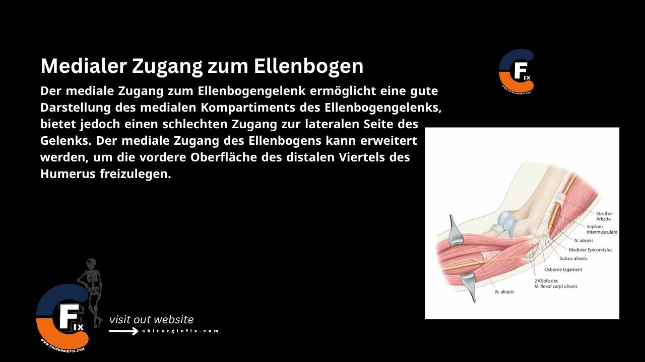 medial approach to the elbow