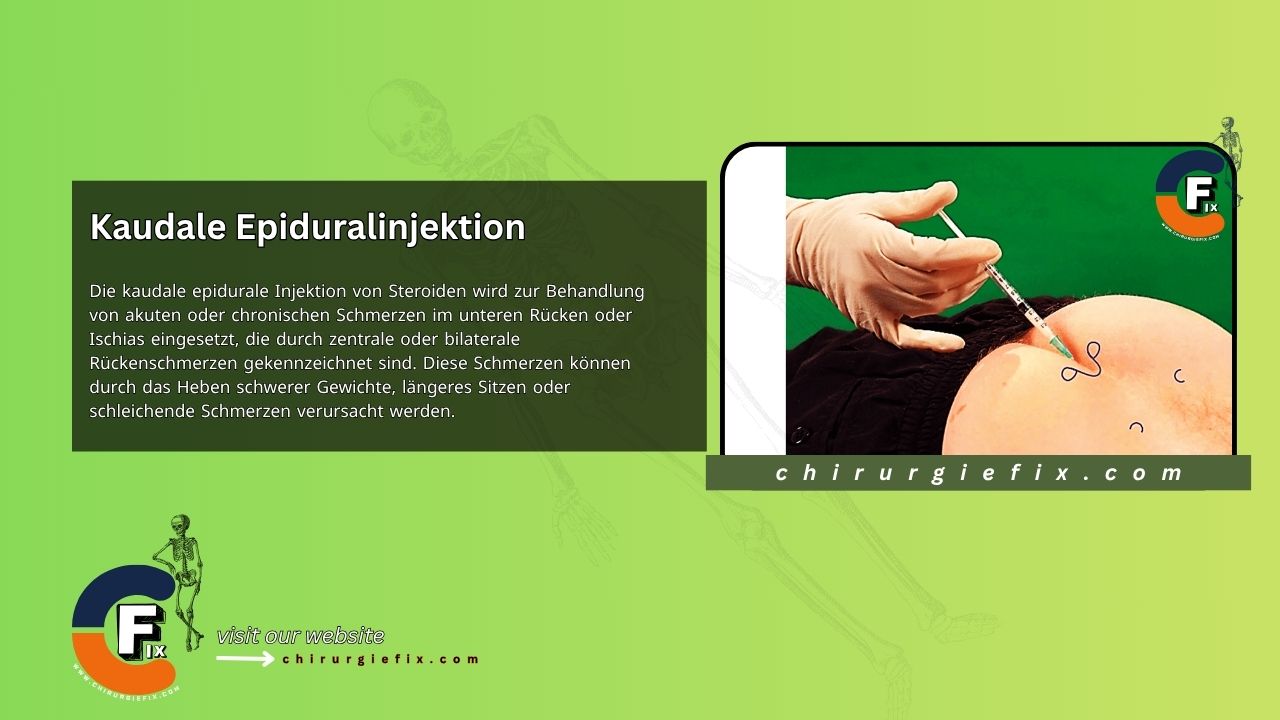 Caudal Epidural Injection