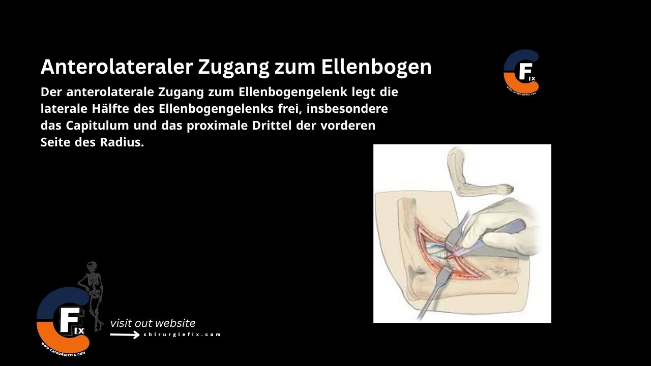 anterolateral approach to the elbow