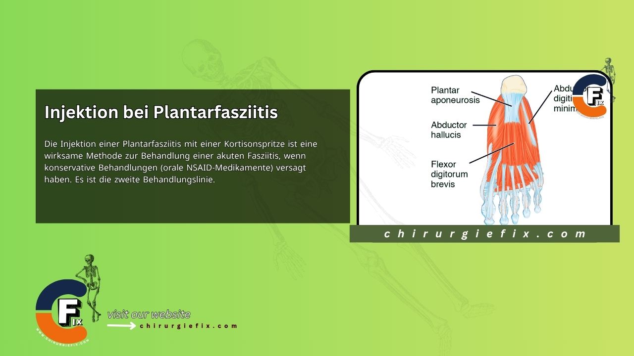 Plantar Fasciitis Injection