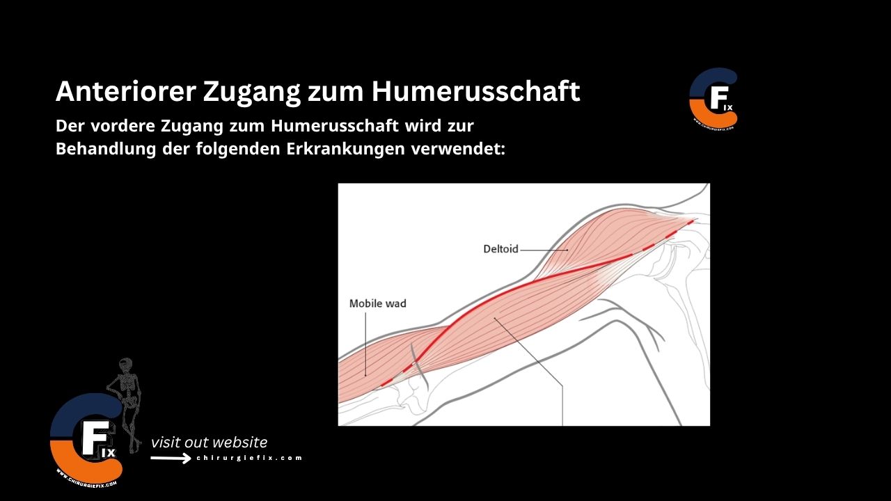 anterior approach to humerus
