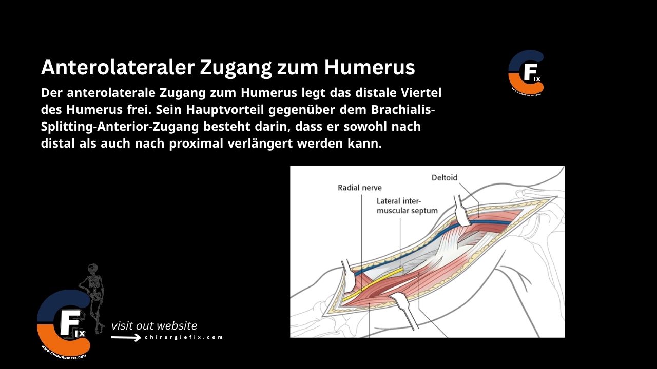 anterolateral approach to the humerus