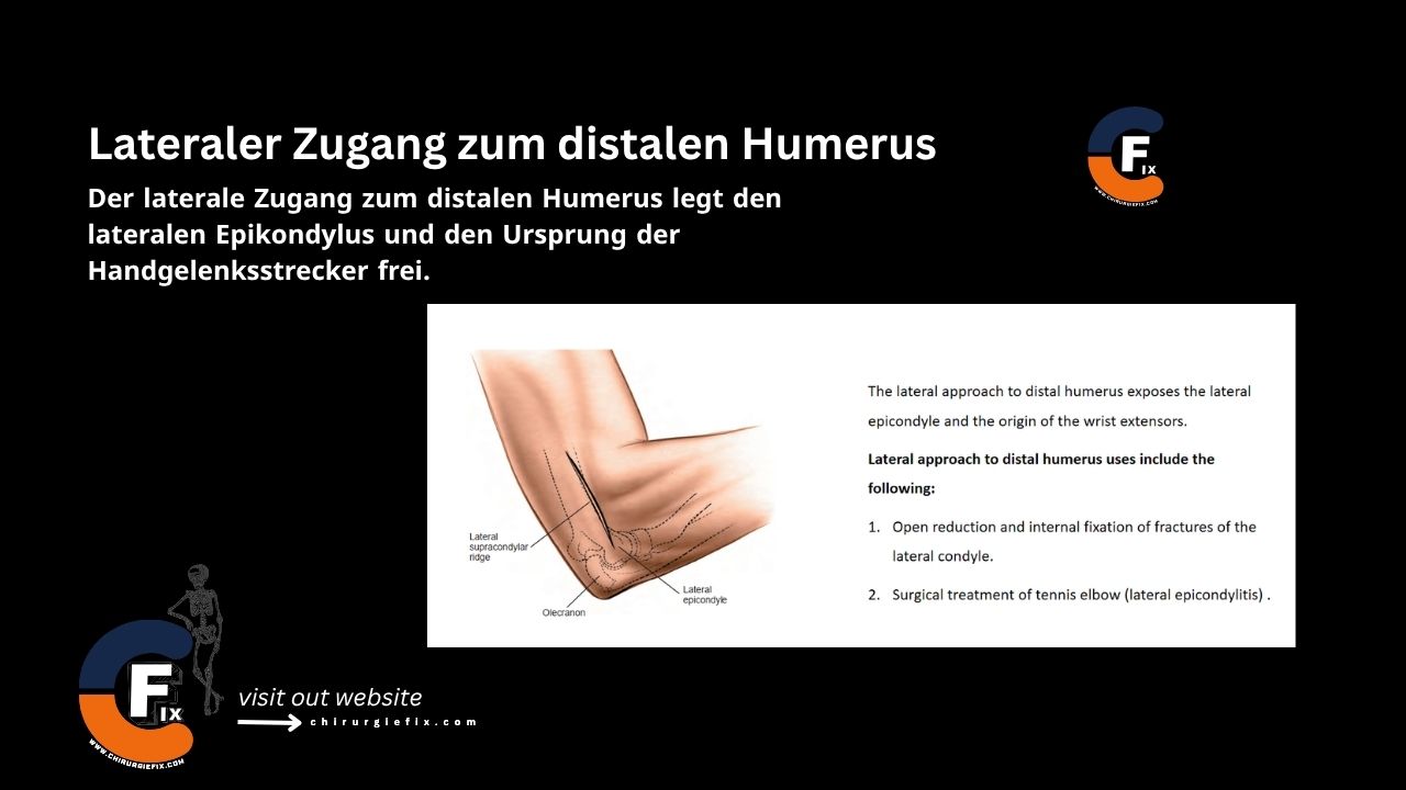lateral approach to distal humerus