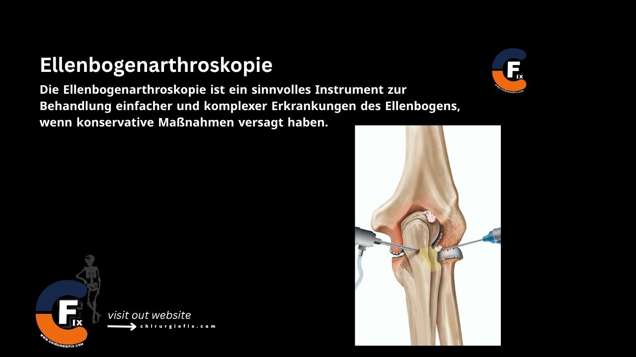 Elbow Arthroscopy