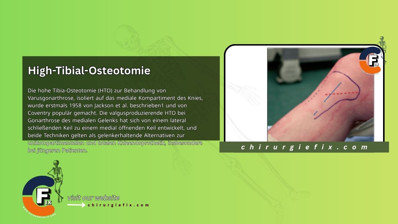 High Tibial Osteotomy