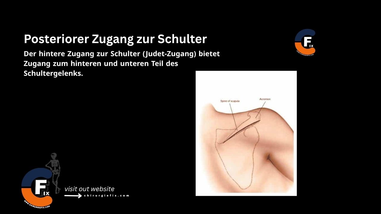 Posterior Approach to the shoulder