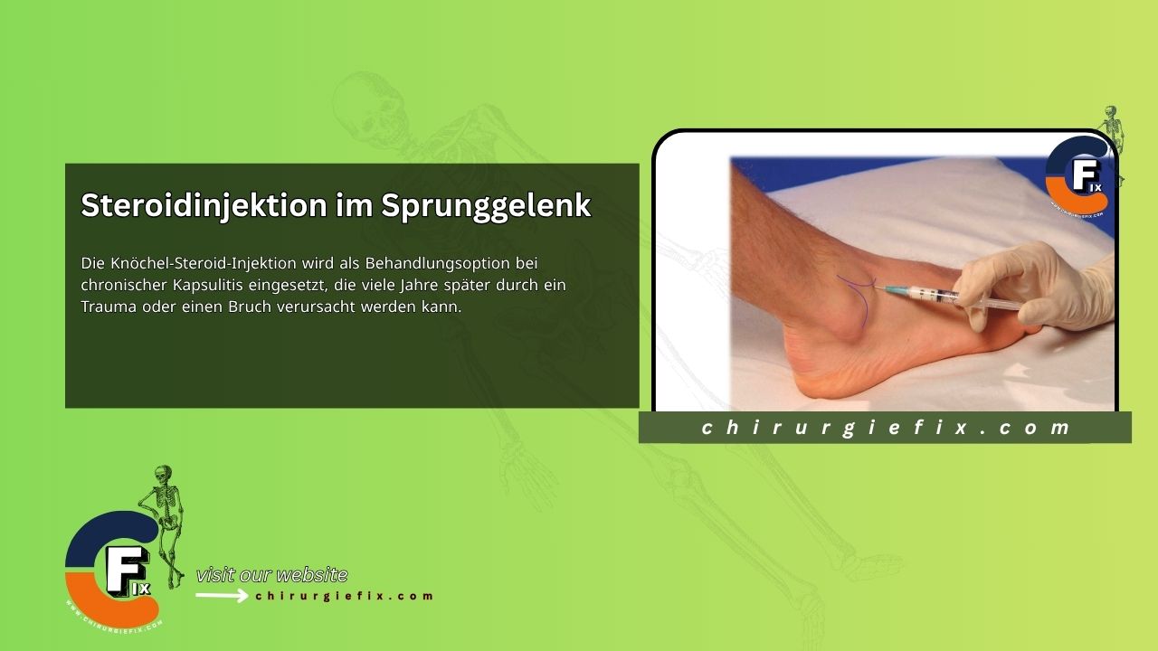 Ankle Steroid Injection