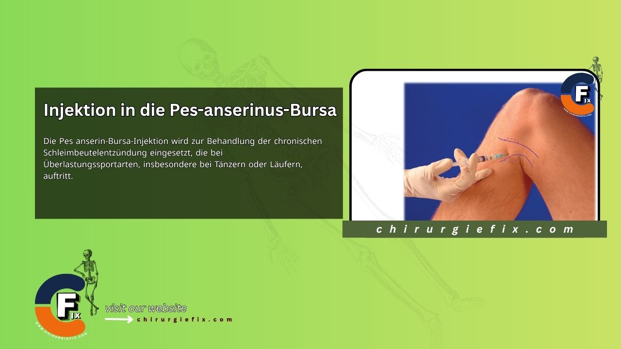 pes anserine bursa injection