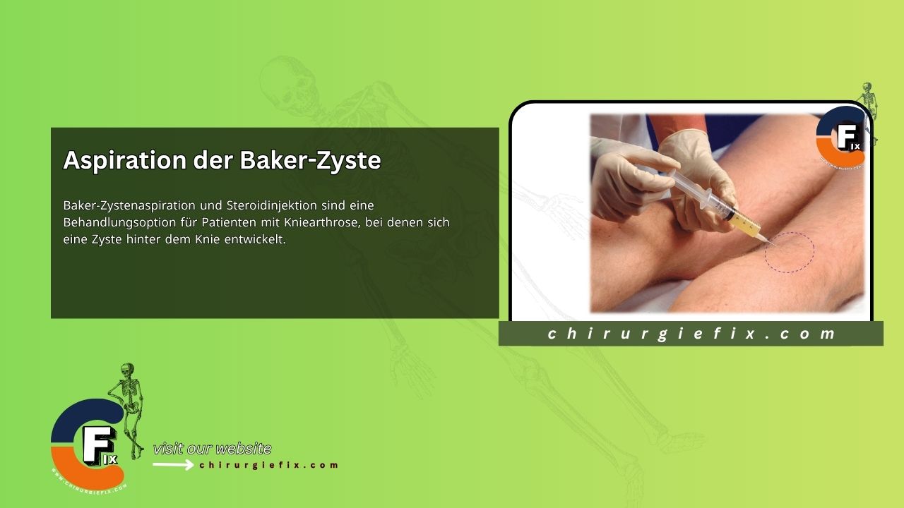 Baker's Cyst Aspiration