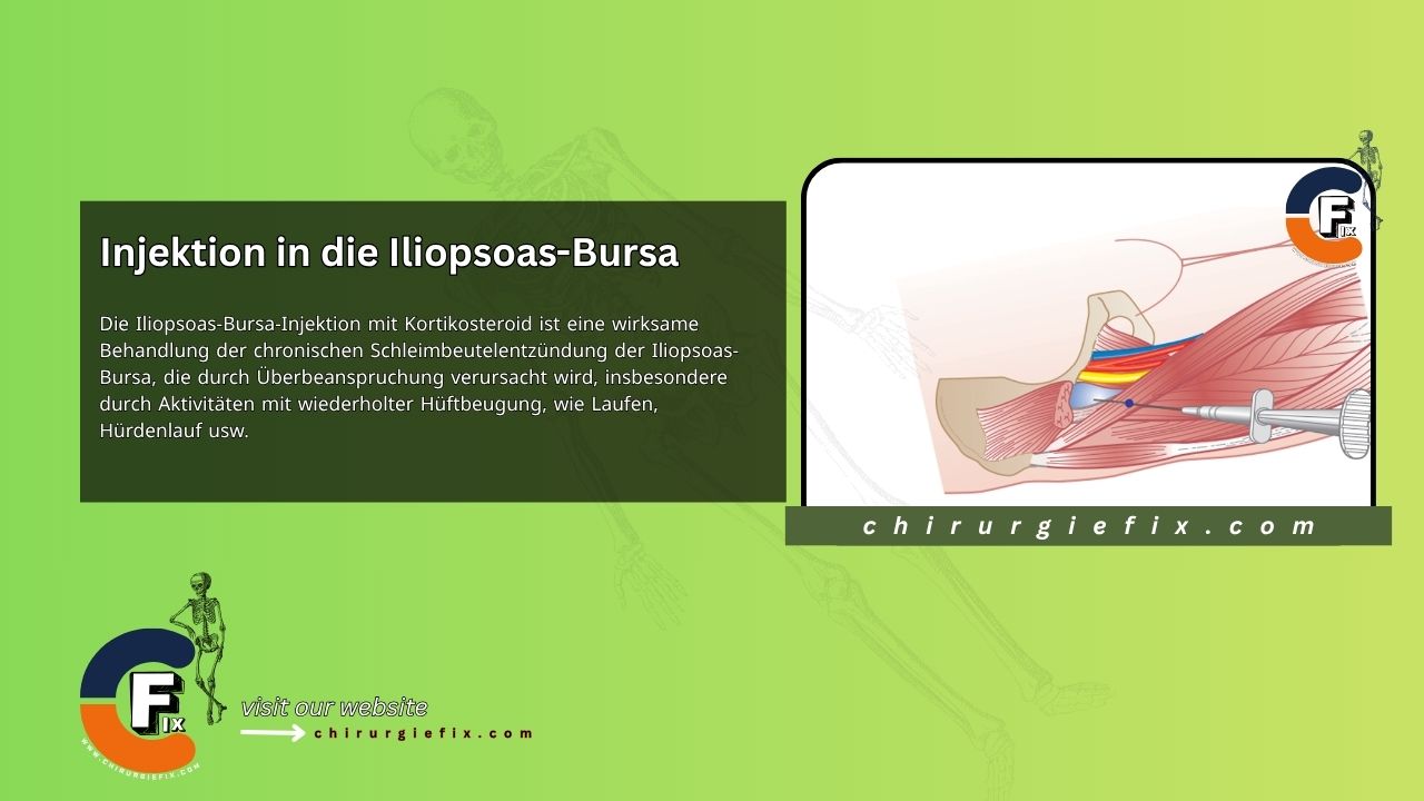 Iliopsoas Bursa Injection
