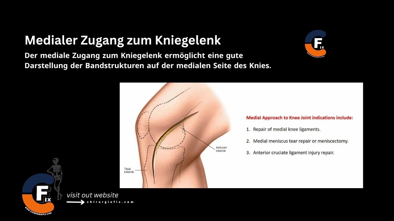 medial approach to knee