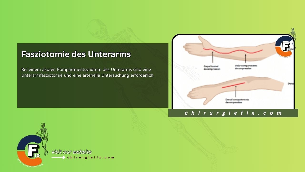 Forearm Fasciotomy