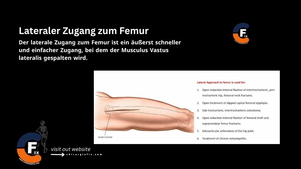 lateral approach to femur