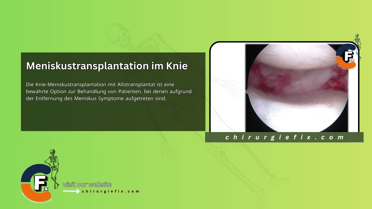 Meniscal Transplantation