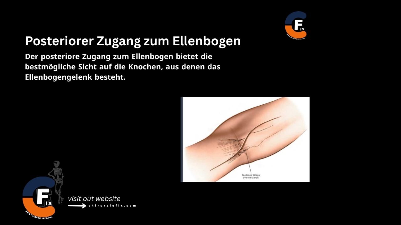 Posterior Approach to the Elbow