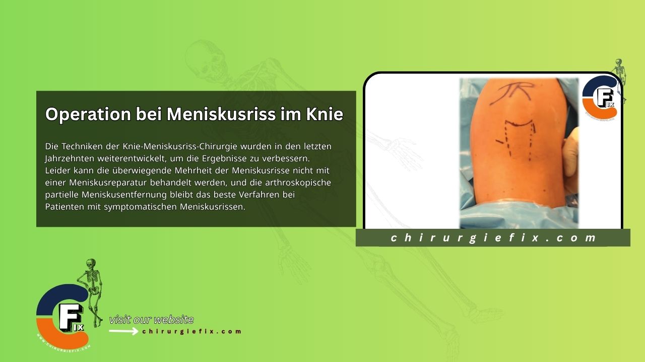 Meniscus Tear Surgery