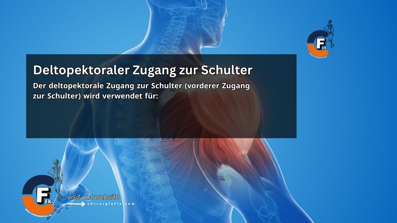 Deltopectoral Approach