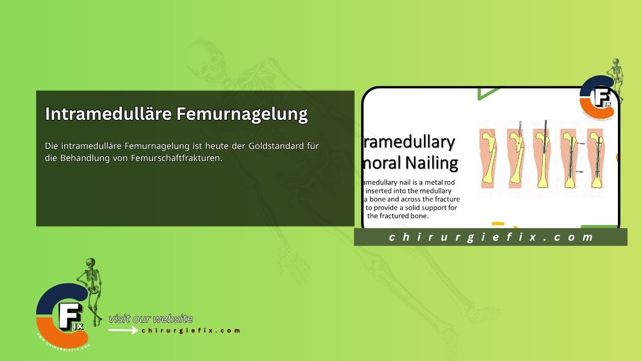 Intramedullary Femoral Nailing