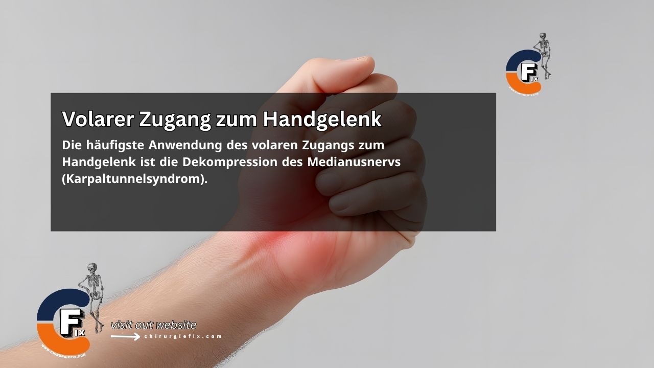 volar approach to the wrist