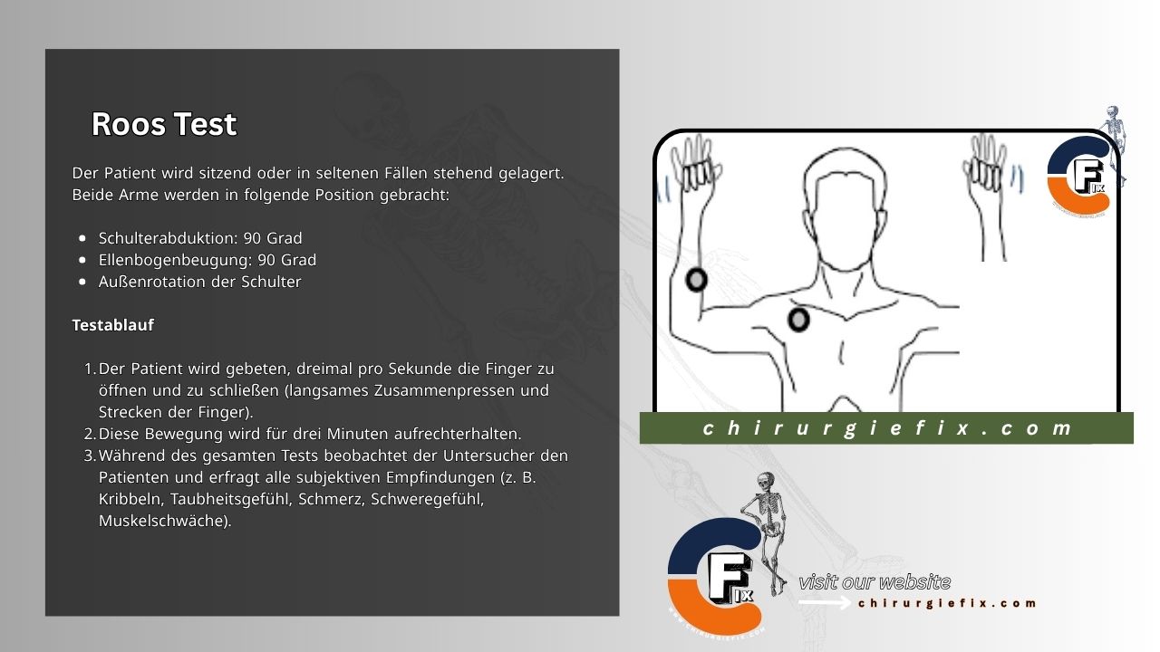 Roos Test