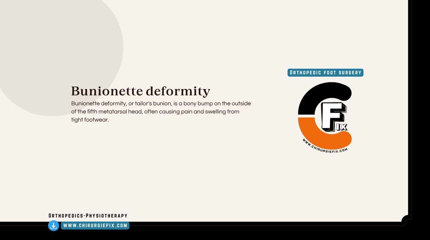 bunionette deformity