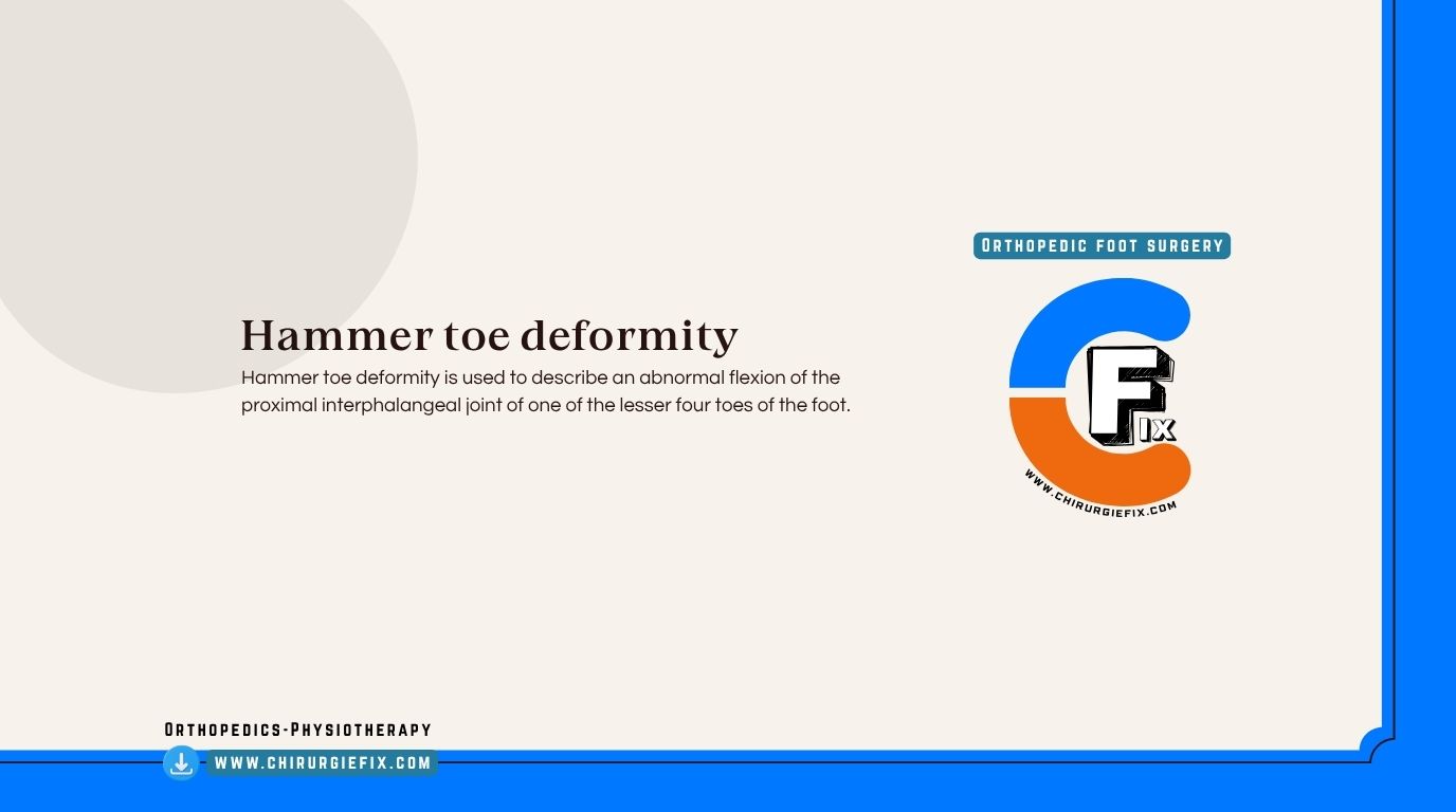 hammer toe