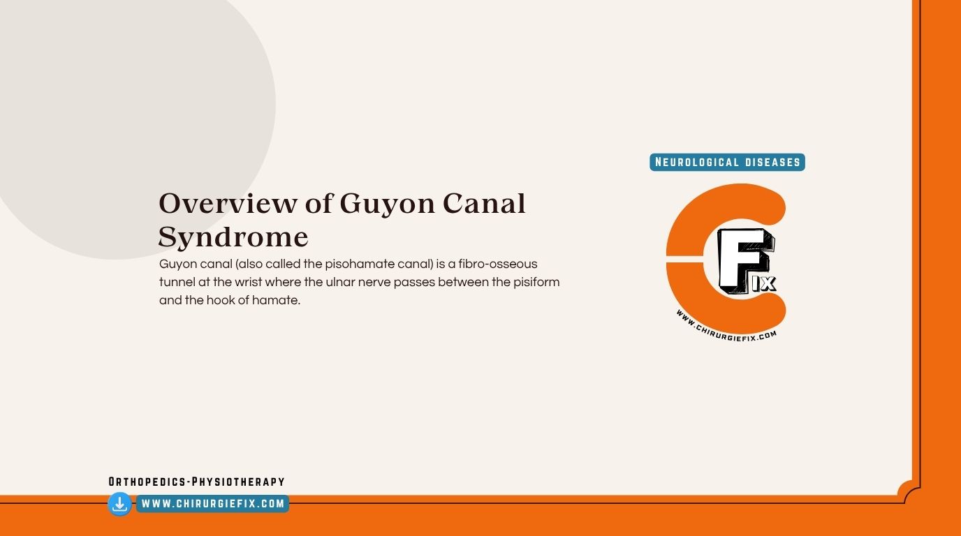 Guyon Canal