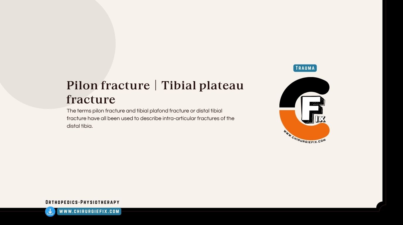 Pilon Fracture