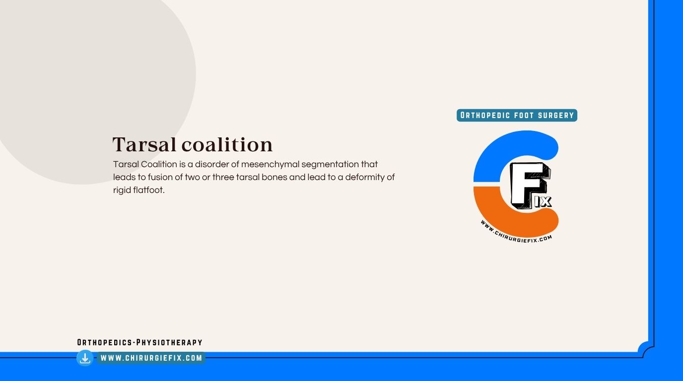Tarsal Coalition
