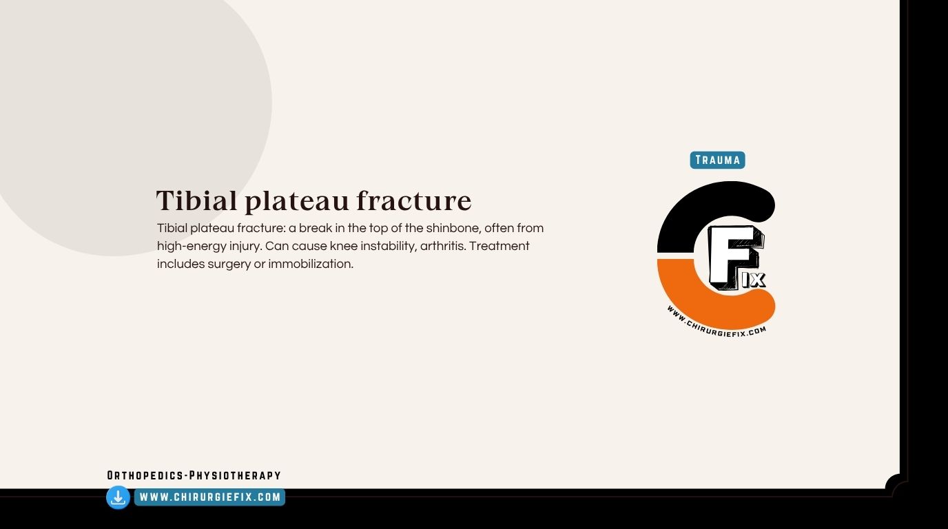 Tibial Plateau Fracture
